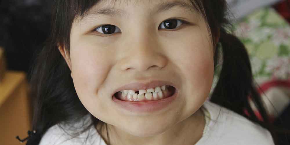 Mft 口腔機能療法 香里園かほりまち歯科 Smile